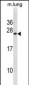 ISCU Antibody (C-term)